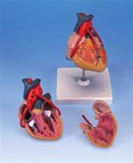 Classic Heart Anatomy with Bypass, 2 part model